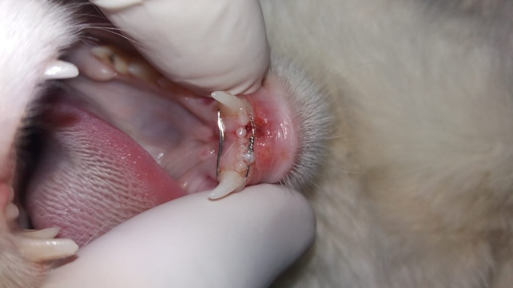 Fratura mandibular - 02